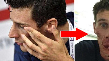 Pierre-Ambroise Bosse révèle une photo de son agression et raconte ce qu'il s'est passé