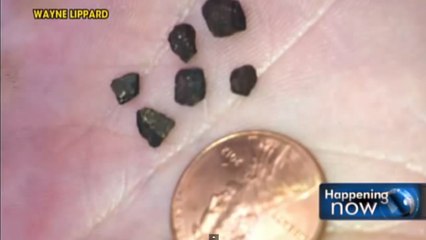 Alors qu'il jouait dehors, Steven Lippard est touché par une météorite en plein tête