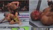 UFC 218 : le visage dévasté de José Aldo après sa défaite contre Max Holloway