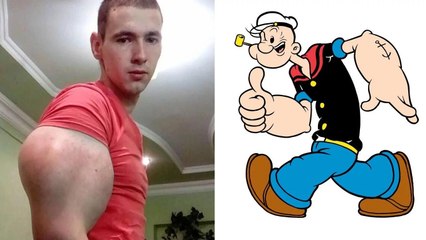 Ce jeune de 21 ans obtient des bras à la Popeye en s'injectant du synthol