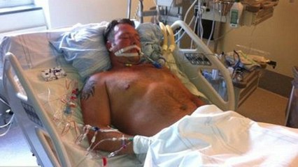Annoncé en état de mort cérébrale, Jimi Fritze entend la conversation des médecins à propos du prélèvement de ses organes