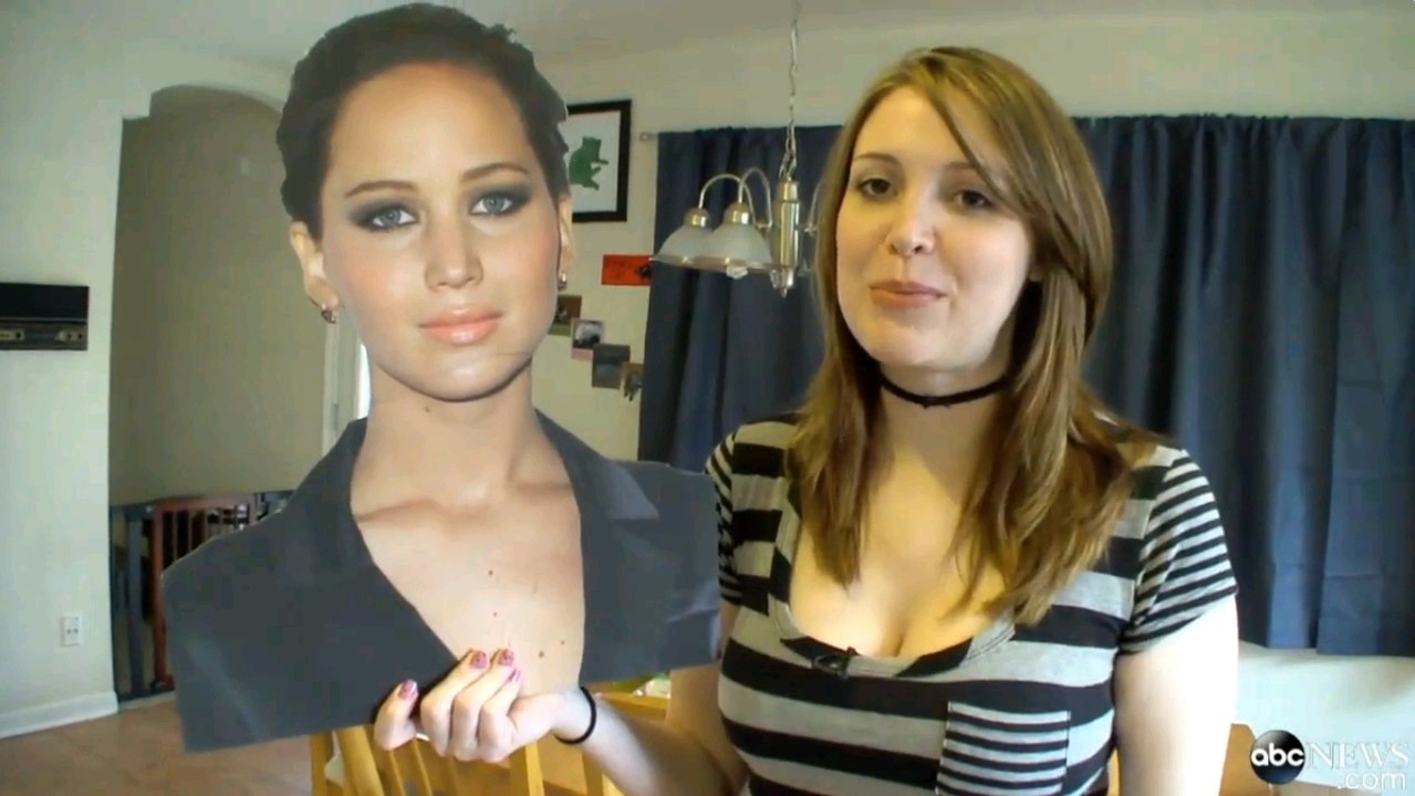 Fan de Jennifer Lawrence, elle dépense 20 000 euros  en chirurgie esthétique pour lui ressembler
