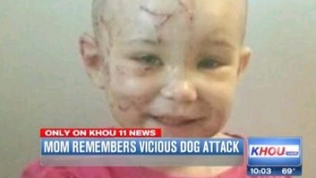 Une mère sauve la vie de sa fille de 2 ans en mordant le pitbull qui l’avait attaquée