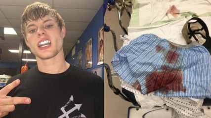 Bryce Mitchell, combattant de l'UFC, s'est déchiré les testicules lors d'un accident domestique