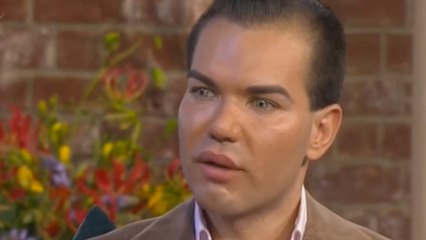 Pour ressembler à Ken, Rodrigo Alves a dépensé plus de 100 000 euros et frôlé la mort