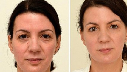 Cette femme a rajeuni de 10 ans avec une méthode incroyable