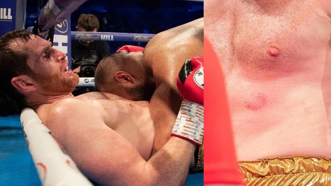 Le boxeur Kash Ali pète les plombs, plaque au sol puis mord au ventre David Price !