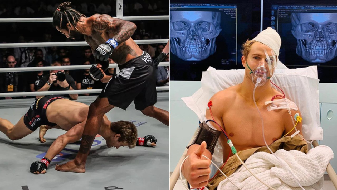 Sage Northcutt se fait détruire pour ses débuts au One : KO en 28 secondes et... 8 fractures au visage !