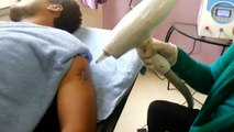 Voici à quoi ressemble une séance pour se faire retirer un tatouage au laser