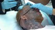 Tatoué sur son visage, cet homme décide de se faire enlever ses tatouages au laser