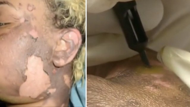 Cette tatoueuse est la meilleure pour masquer les cicatrices