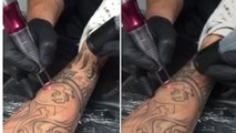 Un jeune homme se fait retirer un immense tatouage à la jambe avec la technique du laser