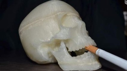 Le Bon Coin : il vend le crane d'un réducteur de tête