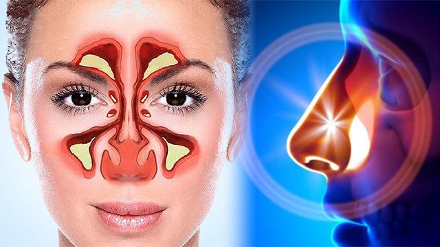 Nose की Bone टेढ़ा होना है बेहद खतरनाक जानें Symptoms, कारण और उपाय । Boldsky