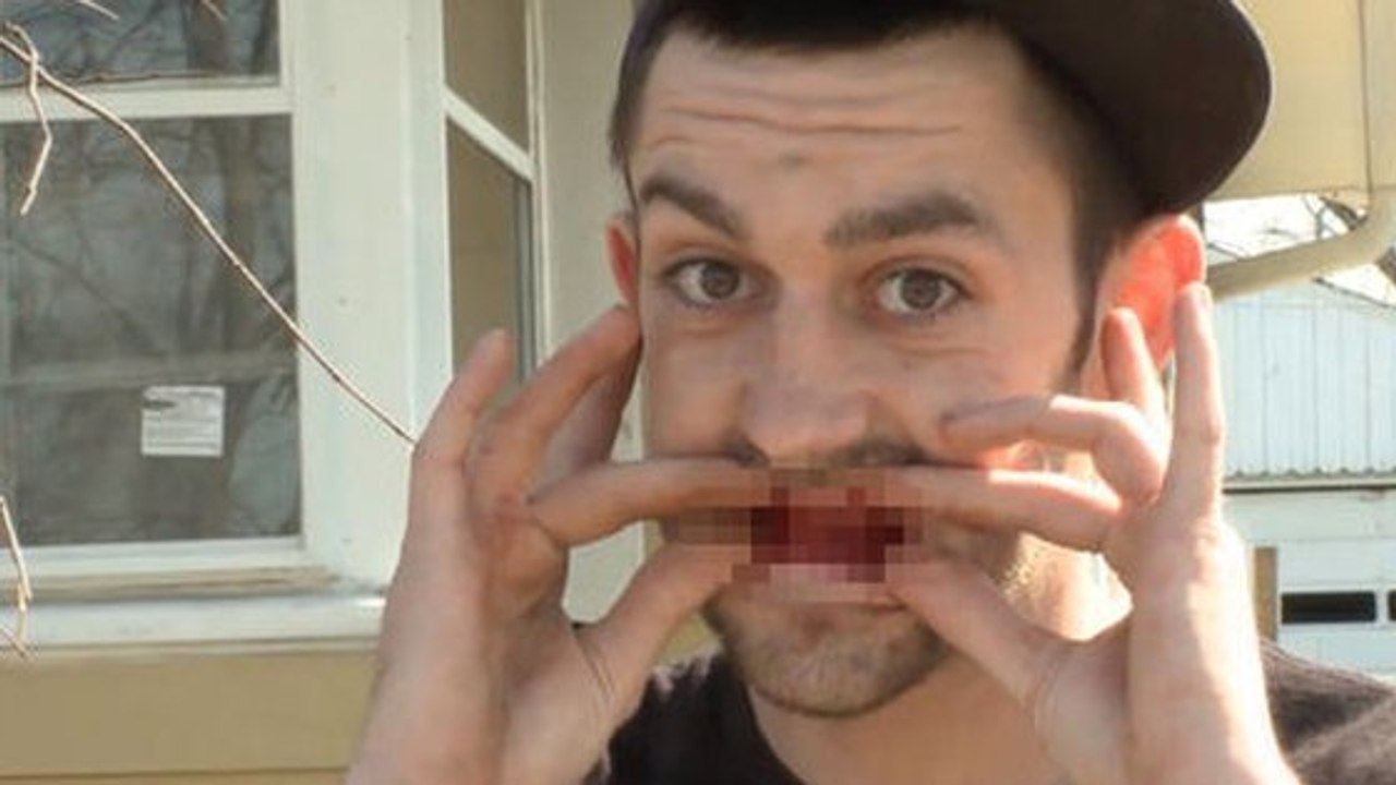 Son dentiste devait lui arracher trois dents, mais rien ne s'est passé comme prévu