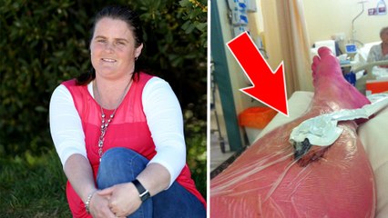 Melissa King : Après 10 kilomètres de marche, ses jambes ont explosé