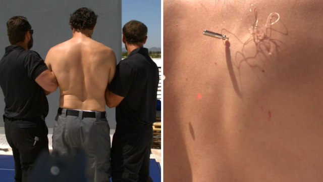 L'effet d'un Taser sur un corps nu filmé en 28 000 images pas seconde