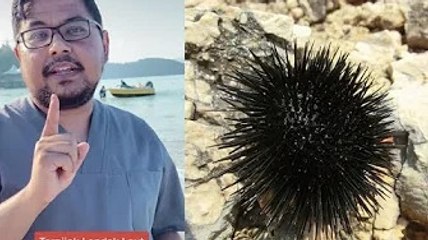 Seronok di pantai, tiba-tiba kaki sakit dan kebas! Jangan panik... doktor, penyelam kongsi apa perlu