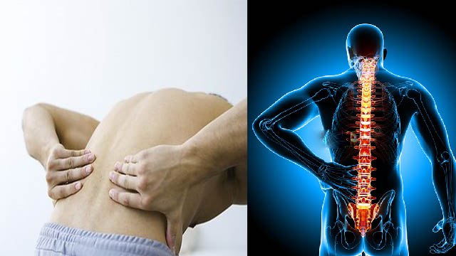 पुरुषों में कमर दर्द के कारण | Purush Ke Kamar Mein Dard Ka Karan | Boldsky
