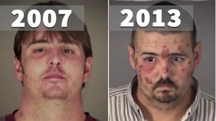 L'association Rehab publie des avants/après choquants pour sensibiliser aux ravages de la drogue