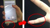 Smartphones : et si leur trop grande utilisation vous déformait les doigts ?