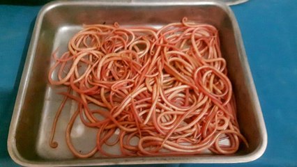 Ses douleurs à l'abdomen cachaient un secret hallucinant