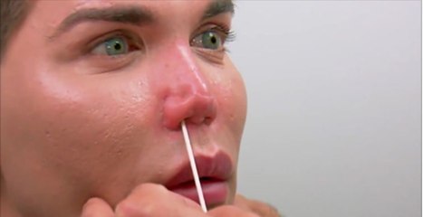 Le sosie de Ken risque de perdre son nez à force d’abuser de la chirurgie esthétique !