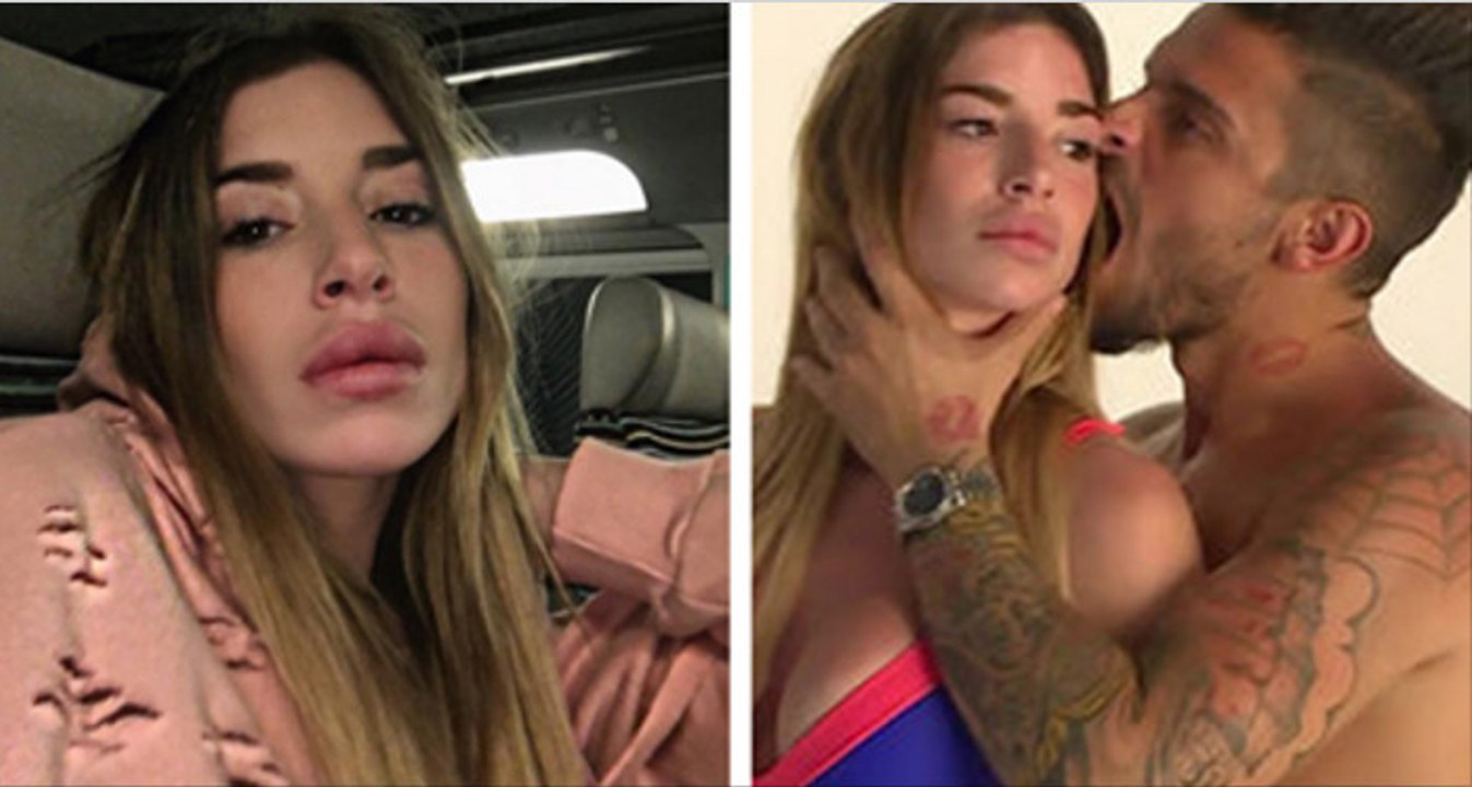 Liam (Les Marseillais South Africa) : Voici à quoi elle ressemblait avant la chirurgie esthétique