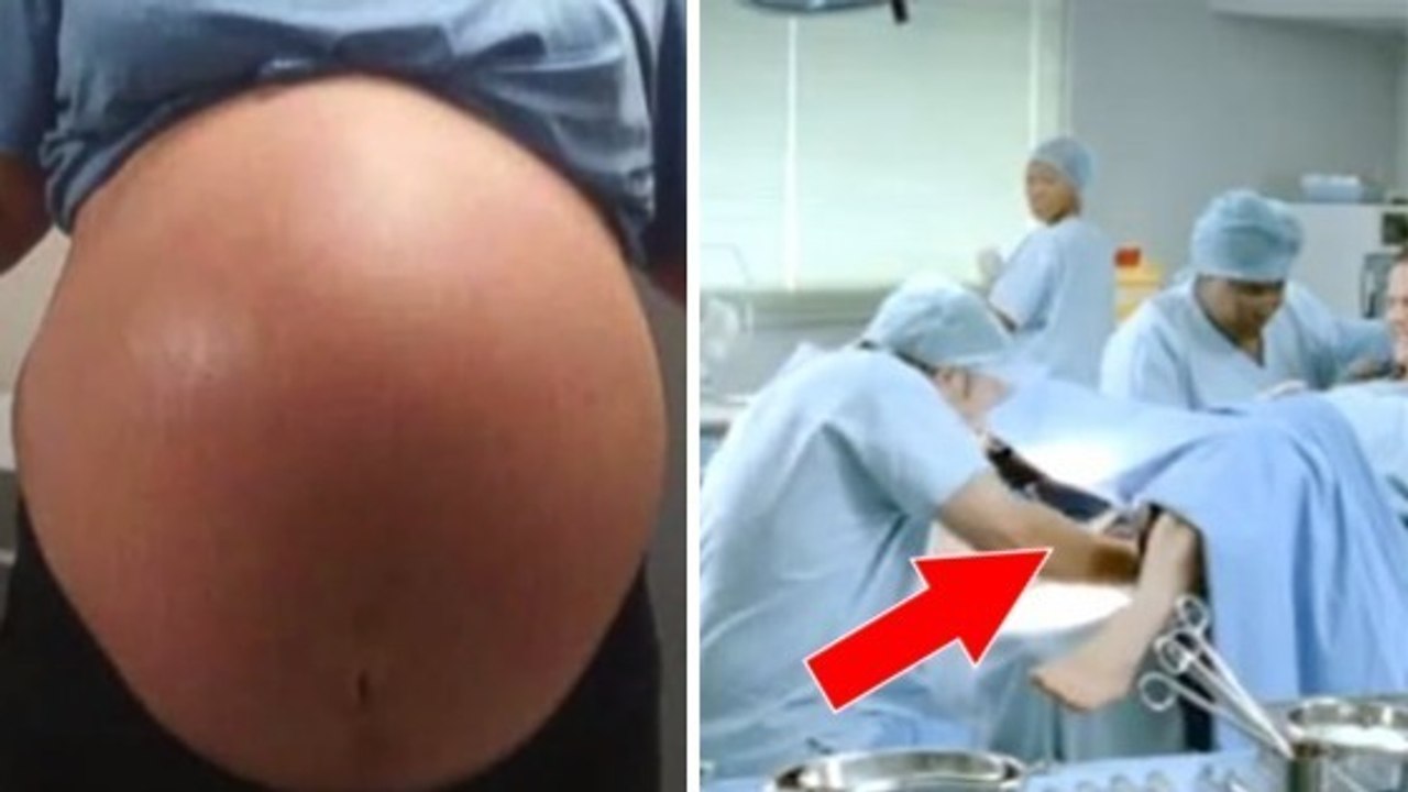 Insolite : Cette femme accouche d'un bébé d'environ 5.8 kilos