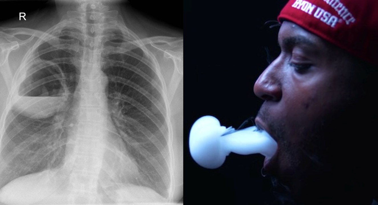 Cigarette électronique : d'après des chercheurs, elle serait aussi néfaste pour nous poumons que la cigarette traditionnelle