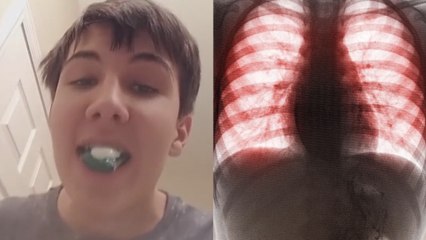 Tide Pod Challenge : une vidéo dévoile ce qui est arrivé à un ado qui a mangé 3 capsules de lessive