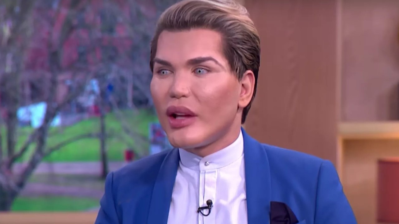 Rodrigo Alves : voici à quoi ressemblait le 'Ken humain' avant toutes ses opérations