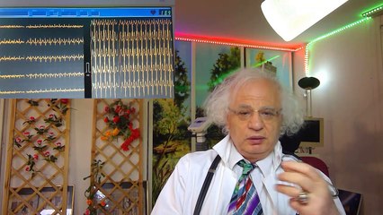 321 VOIR GUERIR CRISE DE TACHYCARDIE EN DIRECT EXTRASYSTOLE PALPITATIONS (2)