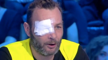 "J'ai tellement la haine" : le gilet jaune ayant perdu un oeil se confie à Thierry Ardisson