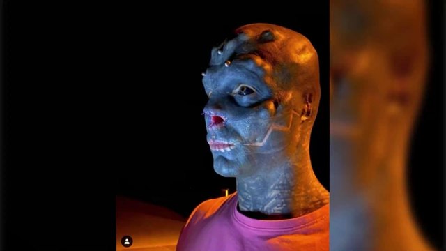 Transformation extrême : un Français se fait retirer le nez et les oreilles pour tester son corps