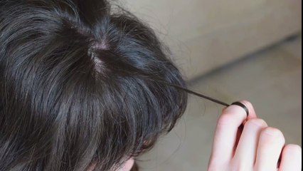 TikTok : Qu'est-ce que le "scalp popping", le nouveau challenge tendance mais dangereux ?