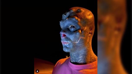 Transformation extrême : après s'être fait enlever le nez et les oreilles, "Black Alien" retire sa lèvre supérieure