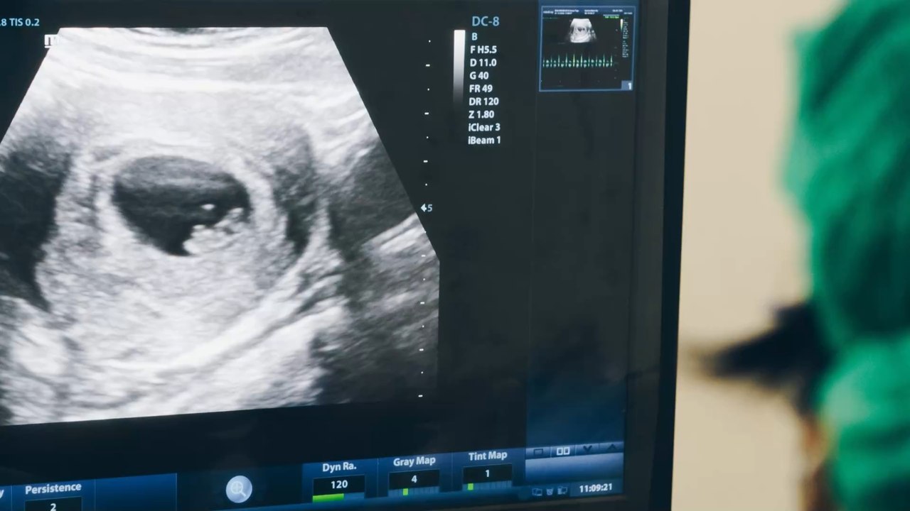 Un bébé grandit dans le foie de sa mère, la vidéo de l'échographie choque TikTok (VIDÉO)