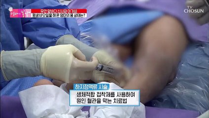 “정말 감사해요” 굽어있던 엄마 허리가 ‘신경성형술’로 반듯↗ TV CHOSUN 20220313 방송
