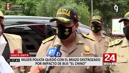 Santa Anita: Policía queda con un brazo destrozado tras ser atropellada por bus “El Chino”