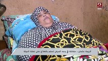 كريمة عثمان مقاتلة في وجه المرض تحلم بالعلاج على نفقة الدولة