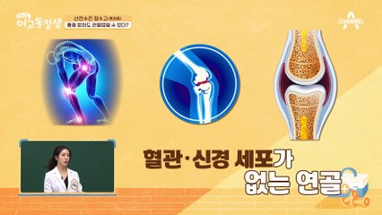 통증이 없어도 관절염을 걱정해야한다?! 갈수록 젊어지는 퇴행성 관절염 환자들