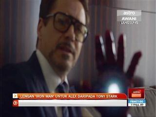 Lengan 'Iron Man' untuk Alex daripada Tony Stark