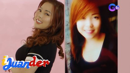 iJuander: Pagpapaganda, inabot ng 1.5 million Pesos?!