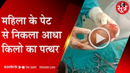 महिला की पहली डिलीवरी और पेट से निकला ये...| Pregnancy |