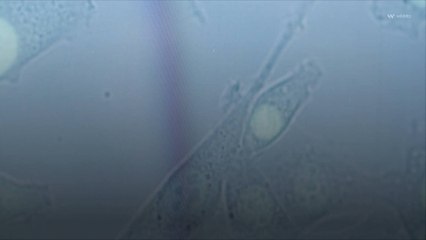 Bactérie E.coli, les autorités sanitaires lancent une campagne de prévention