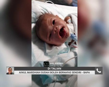 Ainul Mardhiah sudah boleh bernafas sendiri - Bapa