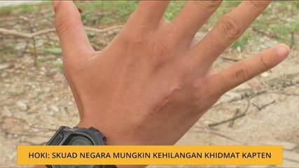 Hoki: Skuad negara mungkin kehilangan khidmat kapten