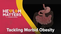 Health Matters with Dishen Kumar: Tackling Morbid Obesity