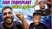 My Successful Hair Transplant Journey | Unbelievable Results | Cherry Vlogs